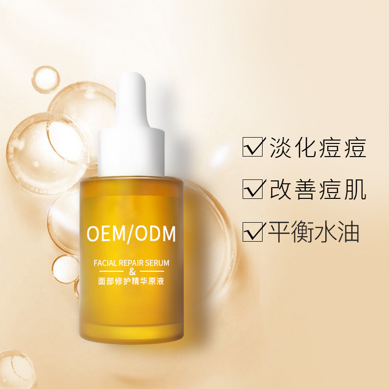 巴彦淖尔市_祛痘精华原液OEM
